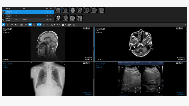 DICOM picture Viewer M-Viewer